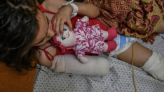 UN: Every day, 10 Gaza children lose one or both legs due to Israel's war