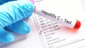 Govt declares hepatitis C national emergency, launches 164m screening drive